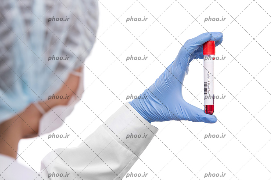 عکس با کیفیت پزشک با لباس مخصوص آزمایشگاه و ظرف آزمایش در دستش و پس زمینه به رنگ سفید