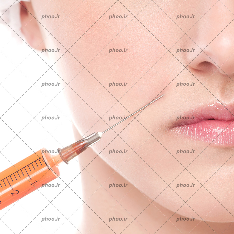 عکس با کیفیت تزریق ژل نارنجی با سرنگ به خط لبخند زن از نمای نزدیک