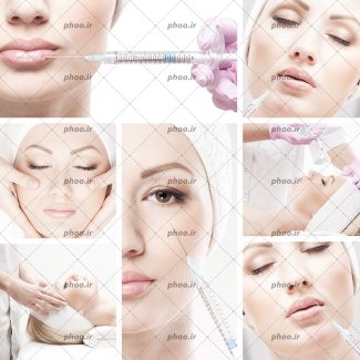 عکس با کیفیت تزریق ژل به لب ها و چروک گوشه چشم و پایین چشم و خط اخم