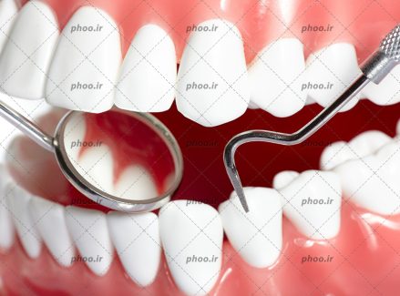 عکس با کیفیت در حال برسی دندان های سفید و براق با آینه مقعر مخصوص دندان پزشکی