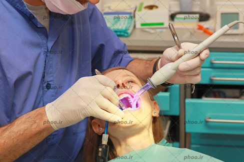 عکس با کیفیت پزشک با روپوش آبی و و دستکش در حال پر کردن دندان های زن با دستگاه های مخصوص