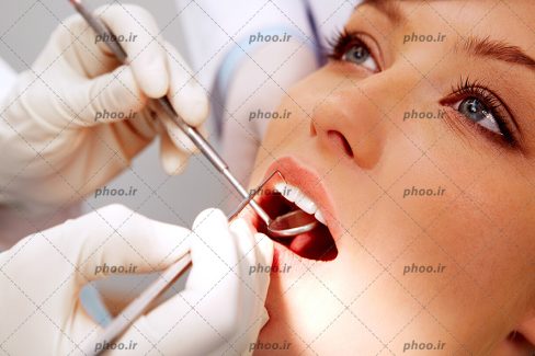 عکس با کیفیت پزشک در حال معاینه کردن و جرم گیری دندان های زن زیبا