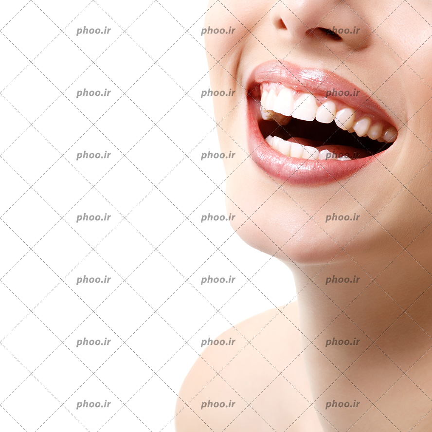 عکس با کیفیت زن در حال خندیدن با لب های خوش فرم و دندان های سفید و درخشان و بک گراند به رنگ سفید