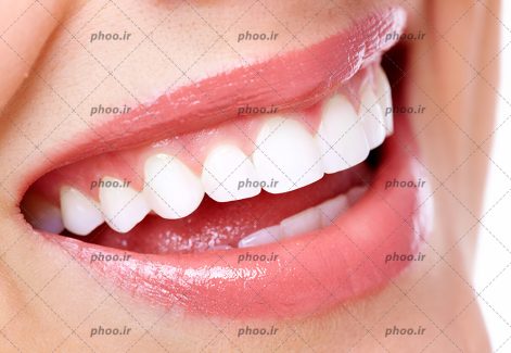 عکس با کیفیت لب های خندان زن و نمایان شدن دندان های سفید و براقش