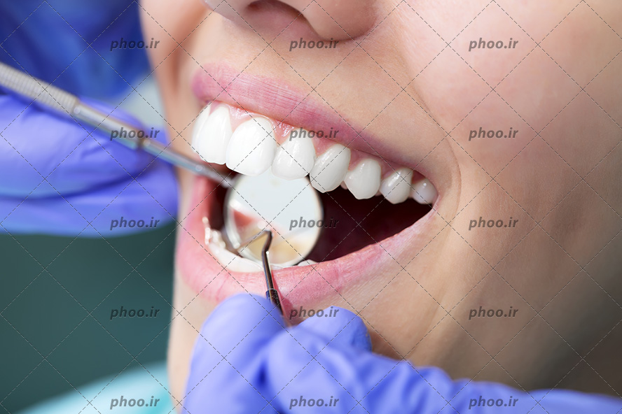 عکس با کیفیت دکتر دندانپزشک در حال برسی دندان های براق و درخشان زن