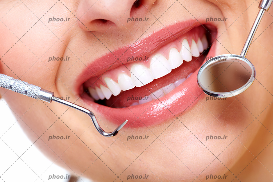عکس با کیفیت زن با لبخند زیبا و دندان های سفید و درخشان و آینه مقعر و قلم دایکال دندانپزشکی در مقابل لب ها