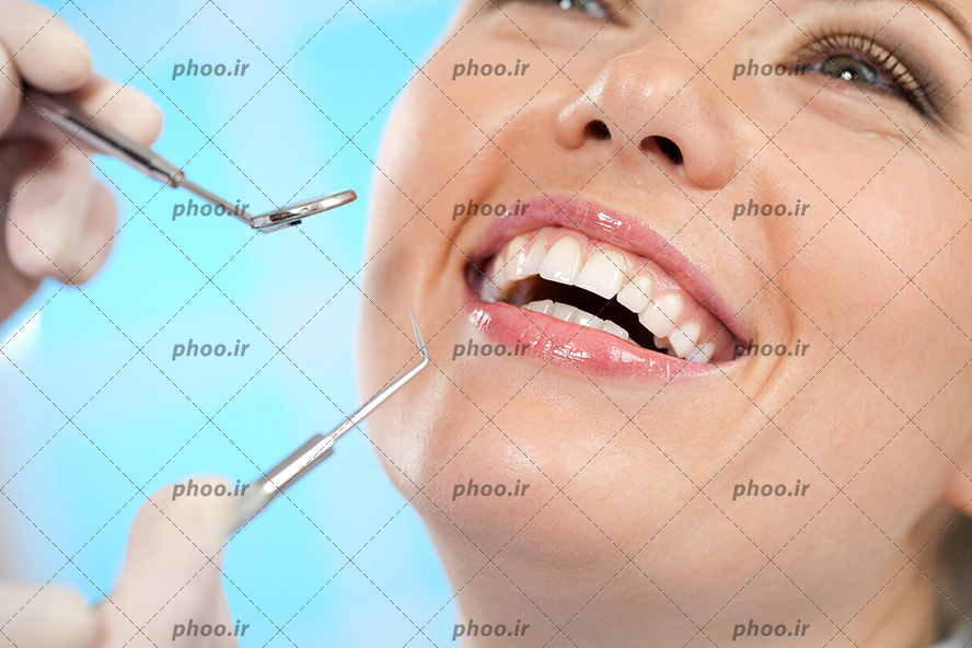 عکس با کیفیت زن در حال خندیدن و نمایان شدن دندان های سفید و درخشان و تجهیزات دندان پزشکی در دست پزشک