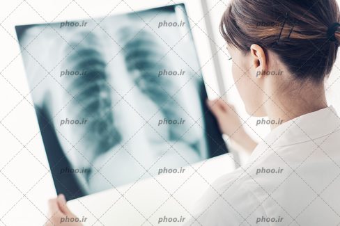 عکس دکتر در حال بررسی تصویر اشعه ایکس بیمار بر روی کامپیوتر