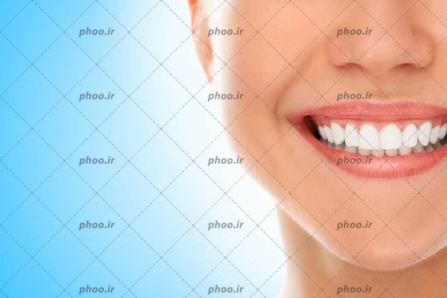 عکس با کیفیت زن با لبخند زیبا و جرم گیری شده و دندان های سفید و براق و پس زمینه به رنگ آبی