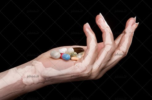 عکس دست انسان و دیده شدن اسکلت آن و قرص هایی در دست